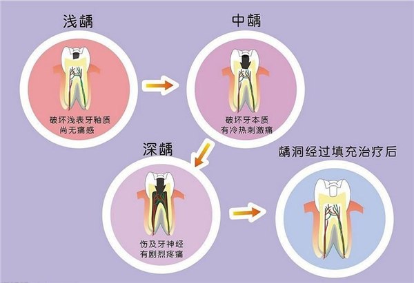 美容牙科网络运营模式,美容牙科和口腔科区别