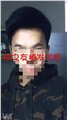 南宁治疗脱发中心推荐/发之友 供应信息