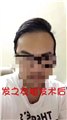 南宁发之友植发怎么样/发之友 供应信息