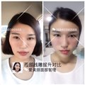沈阳线雕哪家好【艾美丽】沈阳专业线雕微整形| 正规 供应信息